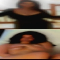Dark skin color